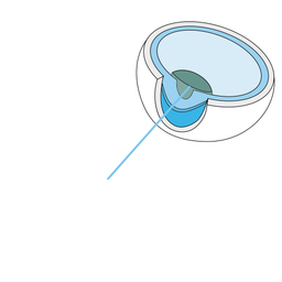 Wavefront_scanning_slide_1