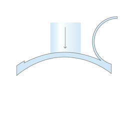 Intralasik_procedure_diagram_slide3