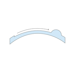 Lasek_procedure_diagram_slide2